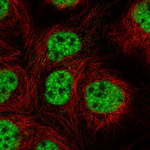 RBPJ Polyclonal Antibody