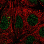 ST14 Polyclonal Antibody