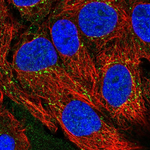 CXCL16 Antibody in Immunocytochemistry (ICC/IF)