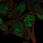 PAT1 Antibody in Immunocytochemistry (ICC/IF)