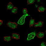 GRIK5 Polyclonal Antibody