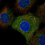 TLR6 Polyclonal Antibody