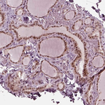 TRIB3 Antibody in Immunohistochemistry (Paraffin) (IHC (P))