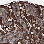 LYK5 Antibody in Immunohistochemistry (Paraffin) (IHC (P))