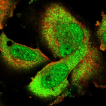 AHR Polyclonal Antibody