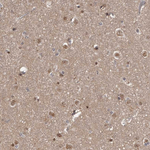 AHR Antibody in Immunohistochemistry (Paraffin) (IHC (P))