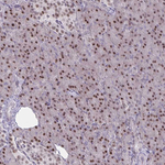 PRMT6 Antibody in Immunohistochemistry (Paraffin) (IHC (P))