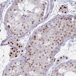 PRMT6 Antibody in Immunohistochemistry (Paraffin) (IHC (P))