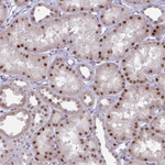 PRMT6 Antibody in Immunohistochemistry (Paraffin) (IHC (P))