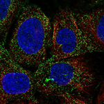 PDGF-D Antibody in Immunocytochemistry (ICC/IF)