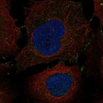 IL13RA2 Antibody in Immunocytochemistry (ICC/IF)