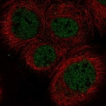 POLL Antibody in Immunocytochemistry (ICC/IF)