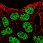 EphB6 Antibody in Immunocytochemistry (ICC/IF)