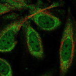CPEB1 Antibody in Immunocytochemistry (ICC/IF)