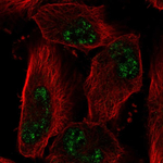 ADAMTS4 Polyclonal Antibody