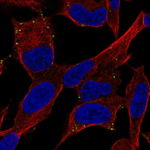 PACAP Receptor Polyclonal Antibody
