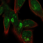 FPR1 Polyclonal Antibody
