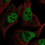 RFC1 Antibody in Immunocytochemistry (ICC/IF)