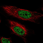 ARIH2 Polyclonal Antibody