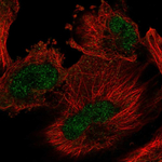 ARIH2 Polyclonal Antibody