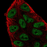 ARIH2 Polyclonal Antibody