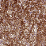 AS160 Antibody in Immunohistochemistry (Paraffin) (IHC (P))