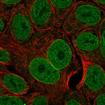 TL1A Polyclonal Antibody