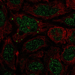 BMP-7 Polyclonal Antibody