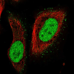 PMS2 Polyclonal Antibody