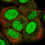 PMS2 Polyclonal Antibody