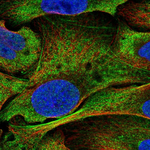 NOTCH3 Polyclonal Antibody