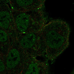 NOTCH3 Polyclonal Antibody