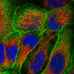 GLUT3 Antibody in Immunocytochemistry (ICC/IF)