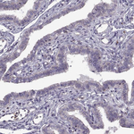 GLUT3 Antibody in Immunohistochemistry (Paraffin) (IHC (P))