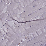 GLUT3 Antibody in Immunohistochemistry (Paraffin) (IHC (P))