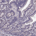 GLUT3 Antibody in Immunohistochemistry (Paraffin) (IHC (P))