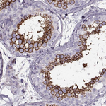 GLUT3 Antibody in Immunohistochemistry (Paraffin) (IHC (P))