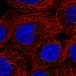 ORM1 Antibody in Immunocytochemistry (ICC/IF)