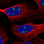 TrkC Polyclonal Antibody