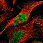 Cyclin E Polyclonal Antibody