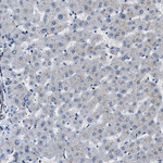 Cyclin E Antibody in Immunohistochemistry (Paraffin) (IHC (P))