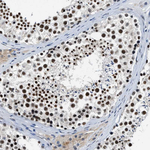 Cyclin E Antibody in Immunohistochemistry (Paraffin) (IHC (P))