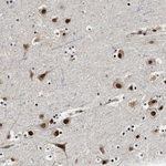 Cyclin E Antibody in Immunohistochemistry (Paraffin) (IHC (P))