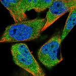 HDAC4 Antibody in Immunocytochemistry (ICC/IF)