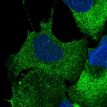 CBF beta Polyclonal Antibody