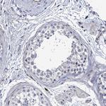 CBF beta Antibody in Immunohistochemistry (Paraffin) (IHC (P))