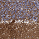 CBF beta Antibody in Immunohistochemistry (Paraffin) (IHC (P))