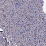 CBF beta Antibody in Immunohistochemistry (Paraffin) (IHC (P))