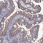 CBF beta Antibody in Immunohistochemistry (Paraffin) (IHC (P))