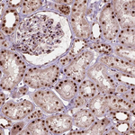 PHAP I Antibody in Immunohistochemistry (Paraffin) (IHC (P))